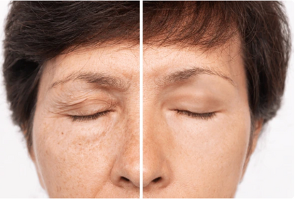 Serum Facial Antiarrugas