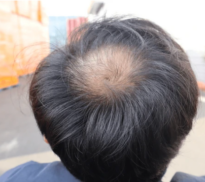 Formula Capilar Anticaida De Cabello